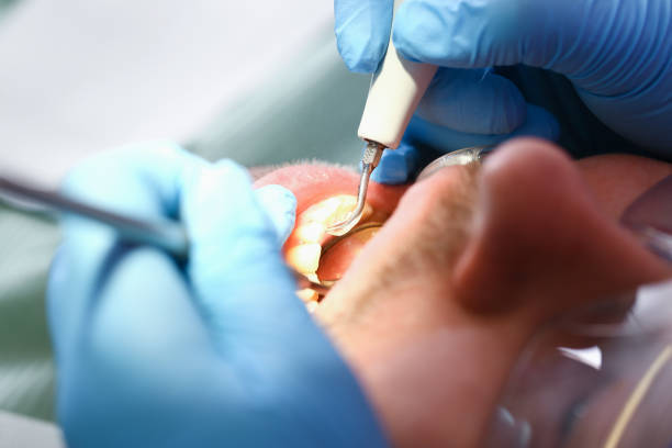 Best Emergency Dental Filling Replacement  in Crystal Lake, IL