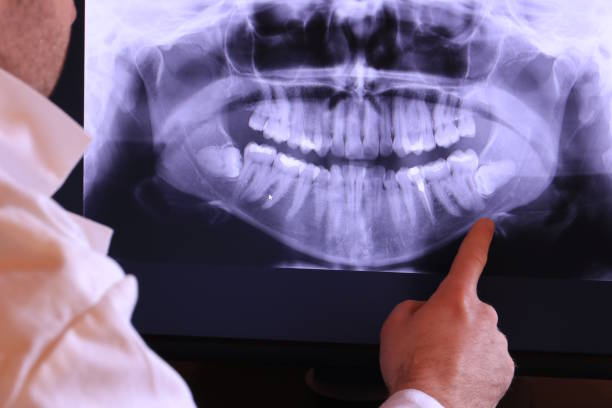Best Tooth Infection Emergency Dentist  in Crystal Lake, IL