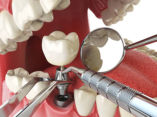 Best Root Canal Emergency Dentist  in Crystal Lake, IL